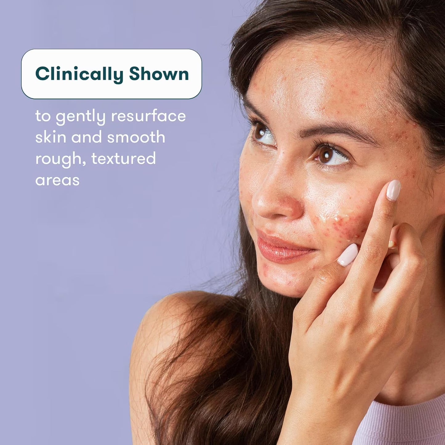Proactiv Post Acne Mark Gel – 1 oz Skin Care Treatment