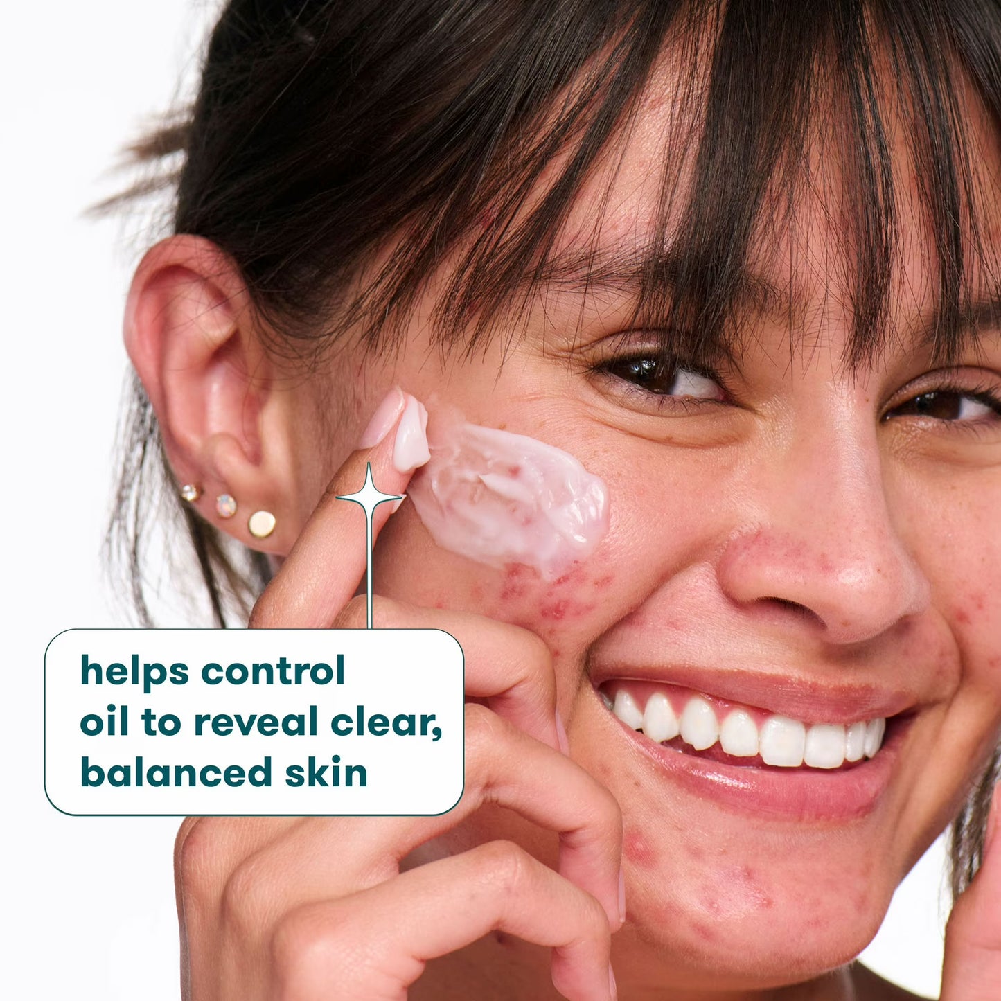 Proactiv Repairing Treatment Step 3 Acne Medication – 2 fl oz