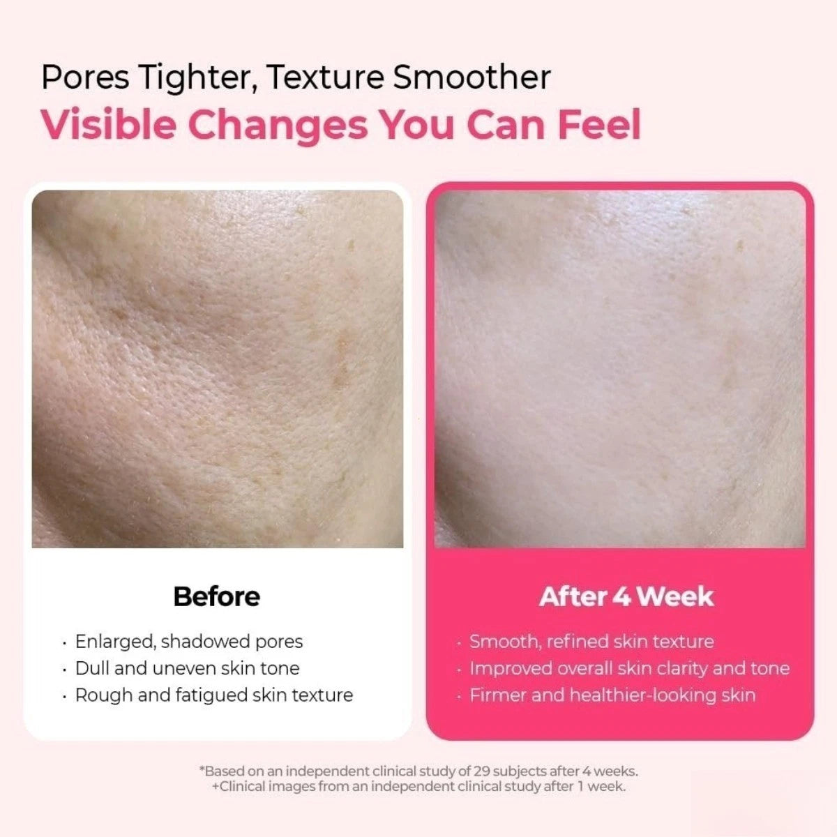 Pink Spicule facial serum designed to support smoother texture and radiant-looking skin.